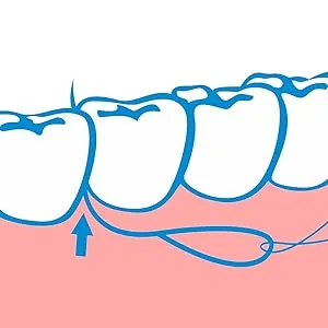 Floss Threaders | for Braces, Bridges, and Implants |210PCS (Pack of 3) 70 Count (Pack of 3) - product information 3