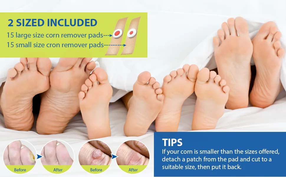 TXL Active Feet Corn Remover, Toe Corn Remover, 30 Pack, Remove Corns Fast, One Step Corn Removers for Feet and Toe, Cushioning Protection Against Shoe Pressure, 30 Pack - Corn