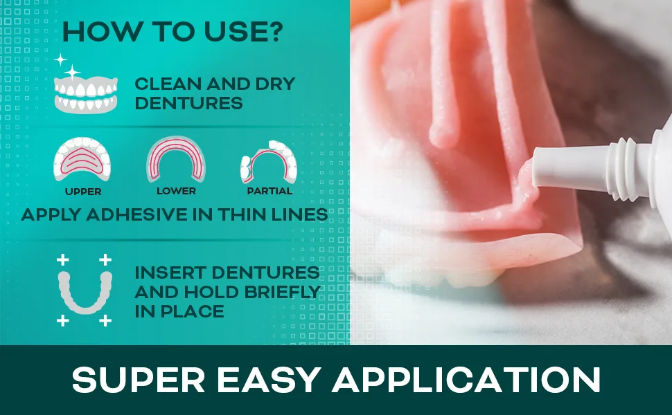 Denture Adhesive Cream (5 Pack) - Extra Strong Hold with Easy Application & Mint Flavour (Zinc & Fluoride Free) - Avistar Adhesive Cream