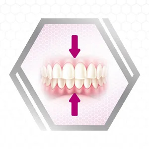 Super Poligrip Original, 2.4-Ounce 3 pack 2.4-Ounce (Pack of 3) - Step 3: Place the denture in your mouth