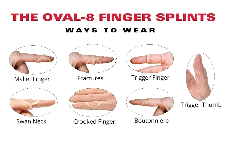 3-Point Products Oval-8 Finger Splint, Support and Protection for Arthritis, Trigger Finger or Thumb, and Other Finger Conditions, 3-Pack, Size 6 Size 6 (Pack of 3) - instructions