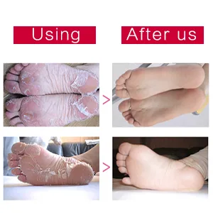 ALIVER Exfoliating Foot Peel Mask Dead Skin Callus Remover - Aloe Vera - Pack of 3 - maskmask