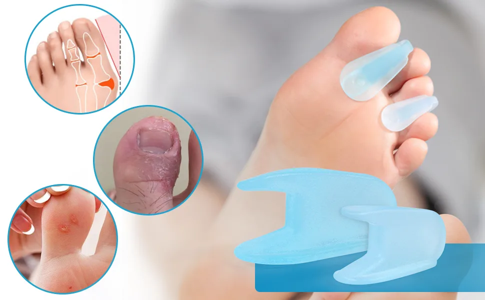 Sumifun 16 Packs Gel Toe Separator, Bunion Corrector and Bunion Relief, Flared Toe Spacers for Overlapping Toe Separators Hammer Toe Straightener for Overlapping Toes(12 Medium + 4 Large Size Blue) Blue2 - product information 9
