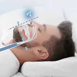 Anti Snoring Device,Helps Stop Snoring Anti Snoring Mouthpiece,Snoring Solution Anti-Snoring Mouth Guard Comfortable and Adjustable White - product information 2