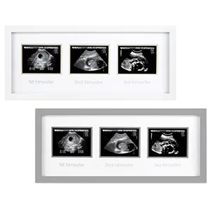 Pearhead Trimester Progression Sonogram Picture Frame, Pregnancy Milestone Keepsake Photo Frame, Gender-Neutral Baby Nursery Dcor, Mothers Day Accessory White - Triple sonogram frame comes in two different colors, white or gray