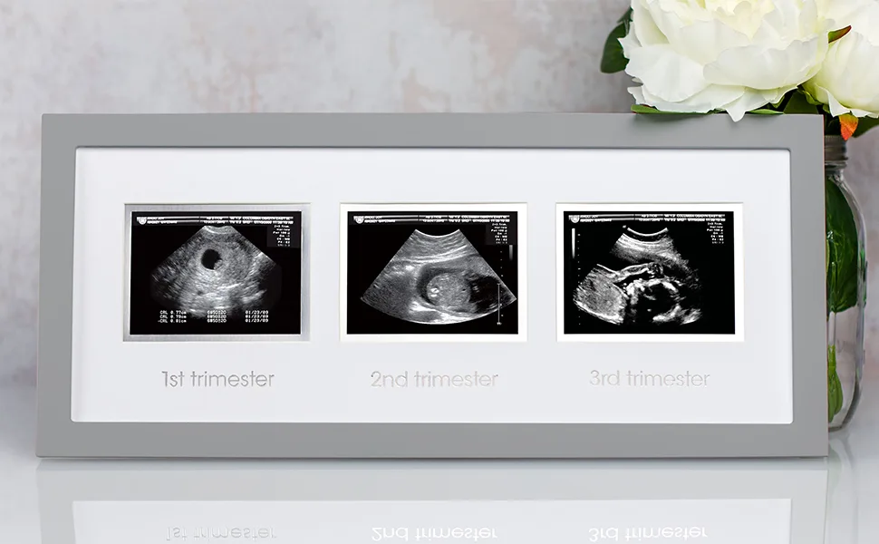 Pearhead Trimester Progression Sonogram Picture Frame, Pregnancy Milestone Keepsake Photo Frame, Gender-Neutral Baby Nursery Dcor, Mothers Day Accessory White - Triple ultrasound frame sitting on table in home