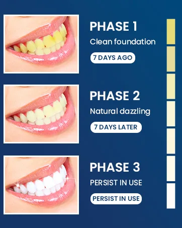 Teeth Whitening 28 Teeth Whitening Strips 14 Sets Teeth Whitener for Teeth Whitening Teeth Whitening Kit-Teeth Whitening Teeth Whitening - teeth whitening