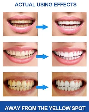2 Pack Teeth Whitening Pen Fast Teeth Whitening Professional Teeth Whitening Whiten Teeth Easily Gentle and Mild on Teeth - product information 5