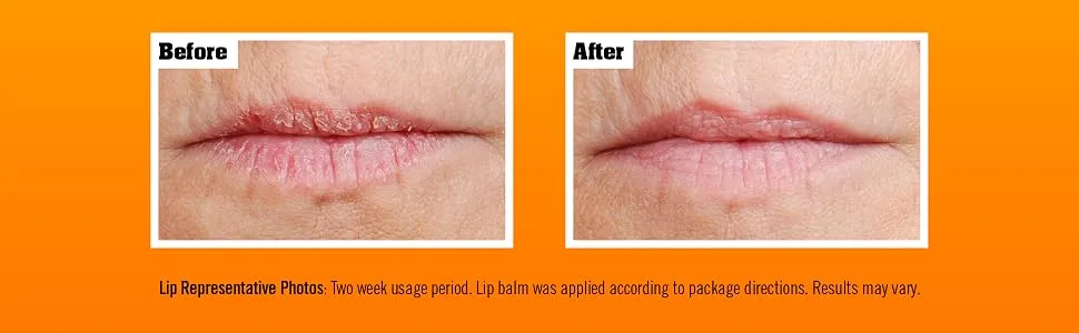 O'Keeffe's Lip Repair Cherry Lip Balm 2 Pack 4.2g - Avant et après