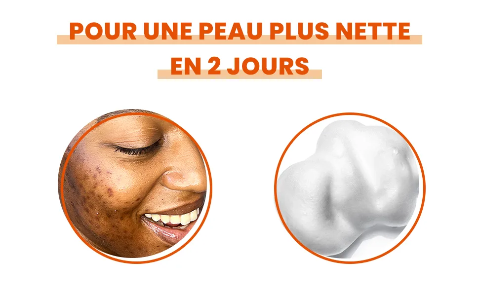 Biore BHA Anti-Pimple Cleansing Foam 200ml - résultats