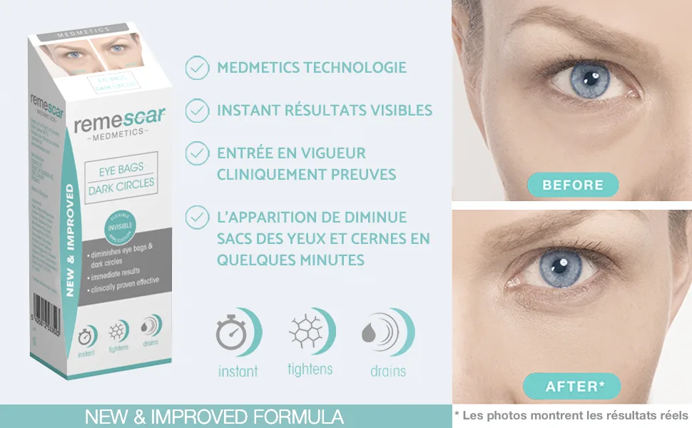 Bags and Dark Circles Cream 2 - product information 2