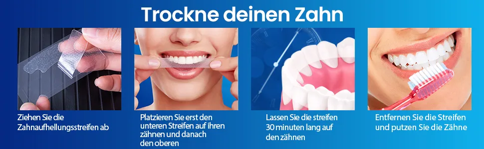 Teeth Whitening Teeth Whitening Strips (15 units (Pack of 1)) - Rayures blanches