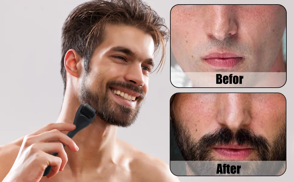 LATTCURE Dermaroller 0.5mm 540 Titanium Needles Roller Beard Derma Roller Beard Growth Roller Derma Roller for Men Stim - Roller Barbe