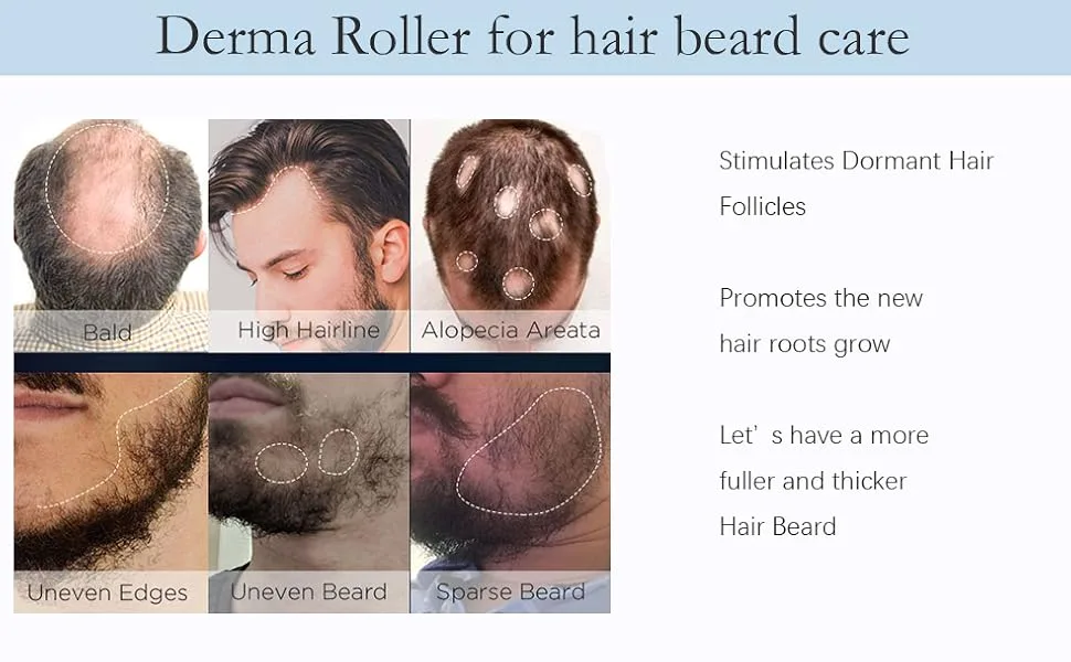Titanium Micro Needle Derma Roller for Face and Body Care Help Men Beard Growth Reduce - Derma Roller pour soins de barbe pour homme, derma roller pour soins capillaires