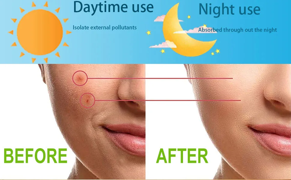 Invisible hydrocolloid patches for treatment of spots and imperfections (216P) - DDT_A04