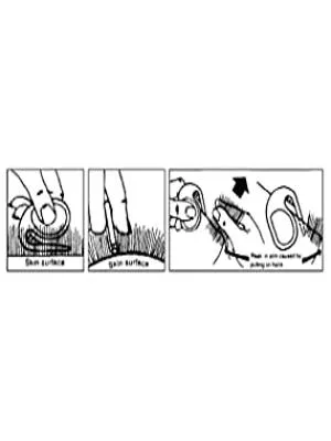 Mikki - 'all Tangled Up' Matt Splitter For Dogs & Cats | Medium/fine Coats - product information 2