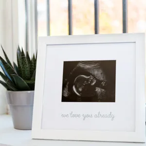 Kate & Milo Love at First Sight Ultrasound Picture Frame, Keepsake Sonogram Frame, Expecting Parent Gift, White Love at First Sight Sonogram Frame - sonogram picture frame