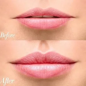 FERNIDA Lip Plumper Device Beauty Pump Quick Lip Plumper Enhancer Bigger Mouth Lip Plumping Device Cherry - product information 24