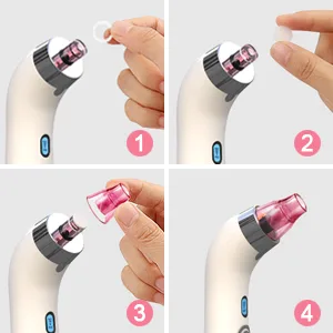 Blackhead Remover Pore Vacuum Electric Blackhead Vacuum Cleaner Blackhead Extractor Tool Device Comedo Removal Suction Beauty Device for Women(Pink) - how to install the blackhead remover