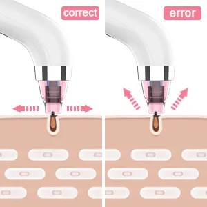 Blackhead Remover Pore Vacuum Electric Blackhead Vacuum Cleaner Blackhead Extractor Tool Device Comedo Removal Suction Beauty Device for Women(Pink) - how to use the blackhead vacuum
