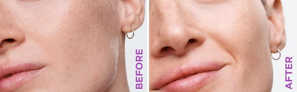 Schick Hydro Silk Dermaplaning Wand Refill Blades  Dermaplaning Refills, 6 Refills, Professional Style 6 Refill Blades - Schick Dermaplaning Face Shaving dermawand tinkle Hydro Silk dermaplaining eyebrow peach fuzz