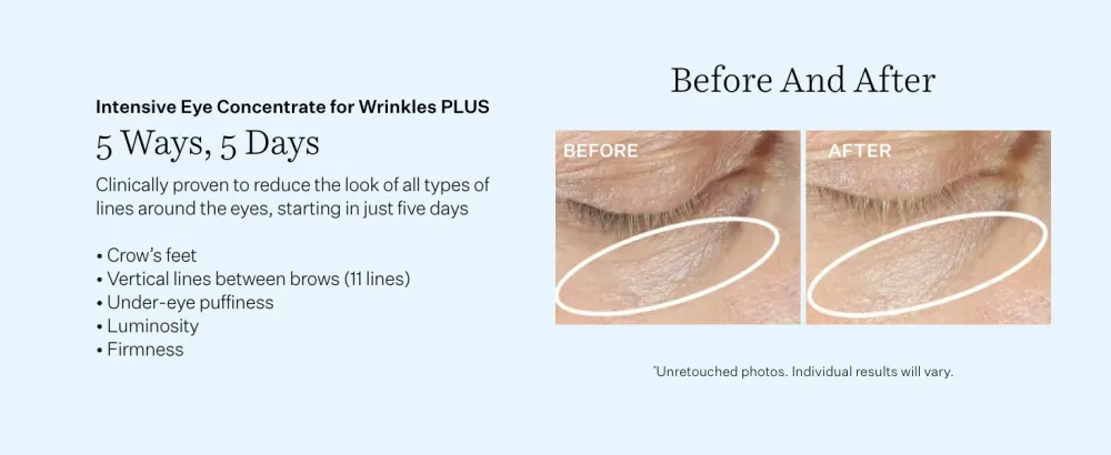 StriVectin SD Advanced Plus Intensive Moisturizing Concentrate for Wrinkles and Stretchmarks, Reduces Look of Deep Wrinkles and Stretchmarks Smooth & Hydrate Set 2 piece Kit - eye B&A