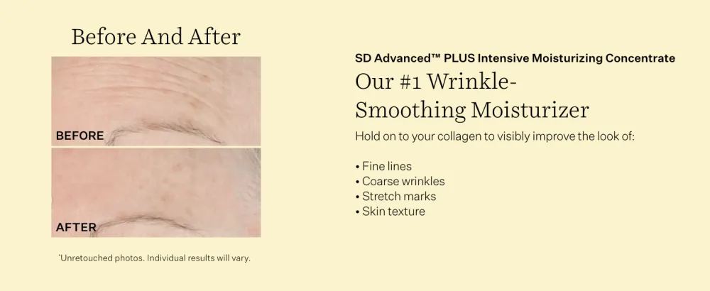 StriVectin SD Advanced Plus Intensive Moisturizing Concentrate for Wrinkles and Stretchmarks, Reduces Look of Deep Wrinkles and Stretchmarks Smooth & Hydrate Set 2 piece Kit - SD b&A