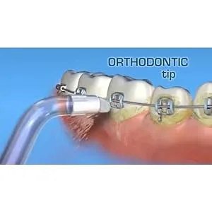 VINFANY Replacement Dental Water Jet Orthodontic Tips for Oral Irrigator Wp100 Wp-450 Wp-250 Wp-300 Wp-660 Wp-900 WP-100 Orthodontic Tips 4 Pack - product information 2