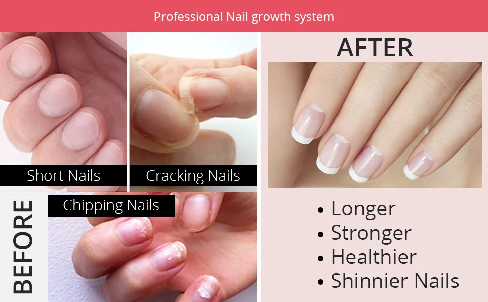Excuse Me Nail Hardener Advanced Formula Strengthener Nail Growth System 0.5 oz (Pack of 2) - fsdf