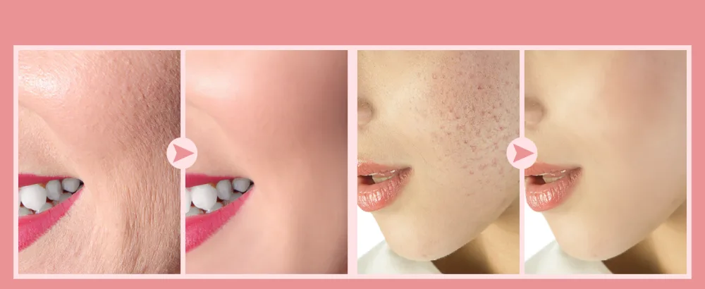 TUMAKOU Portable High Frequency Facial Machine - High Frequency Face Skin Wand Device - product information 16
