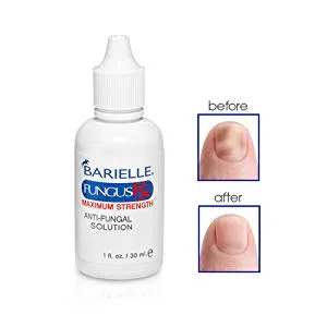 Barielle Fungus Rx 1 ounce - before and after