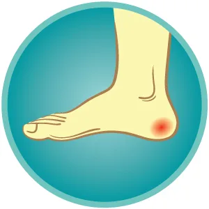 Dr. Scholls Callus Cushions Duragel 5 Count (3 Pack) - What is a callus?