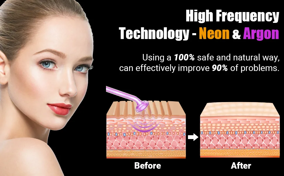 High Frequency Facial Wand - UUPAS Portable High Frequency Facial Machine with 6 Pcs Different Tubes(Orange & Purple) - product information 9
