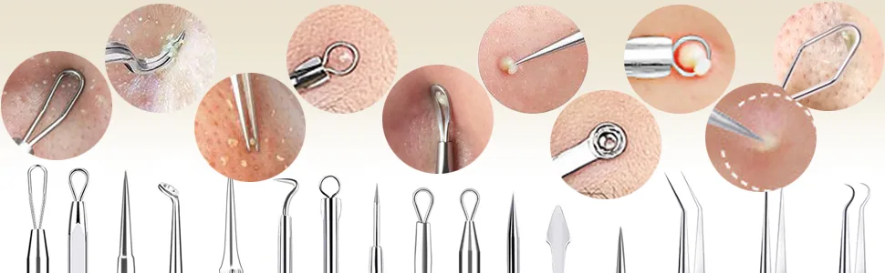 Blackhead Remover Tools, 2023 Latest 16 PCS Pimple Popper Tool Kit, Acne Blackhead Tools for Blemish, 410 Premium Professional Stainless Acne Pimple Extractor Tool with Metal Box - Pimple Popper Tool Kit