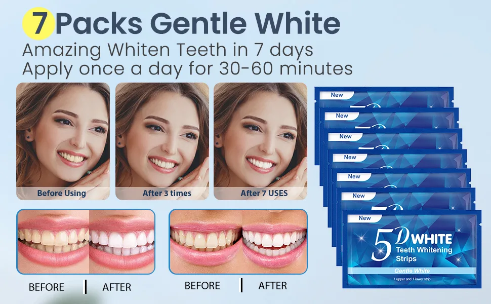 Teeth Whitening Strips, Enamel Safe Teeth Whitening Strips, 14 Sensitive Strips + 4 Instant Strong Whitening Strips for Teeth, Teeth Whitener for Home Use ( 7+2 Pouches ) Mint - Teeth Whitener Strips