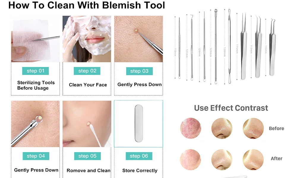 Pinkiou Blackhead Removers Comedone Pimple Popper Tool Acne Extractors Blemish Remover Ingrown Hair Tweezers Removal Kit Whitehead Remover Zit Treatment Skincare Tools for Face Nose, 8-in-1 - Safe and Effective!