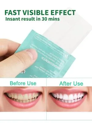 Tevedin Teeth Whitening Strips Non-Sensitive White Strips, 28 Strips Non-Slip Teeth Whitening Kit, Teeth Whitener for Teeth Whitening Remove Smoking Coffee Soda Wine Stain - product information 2