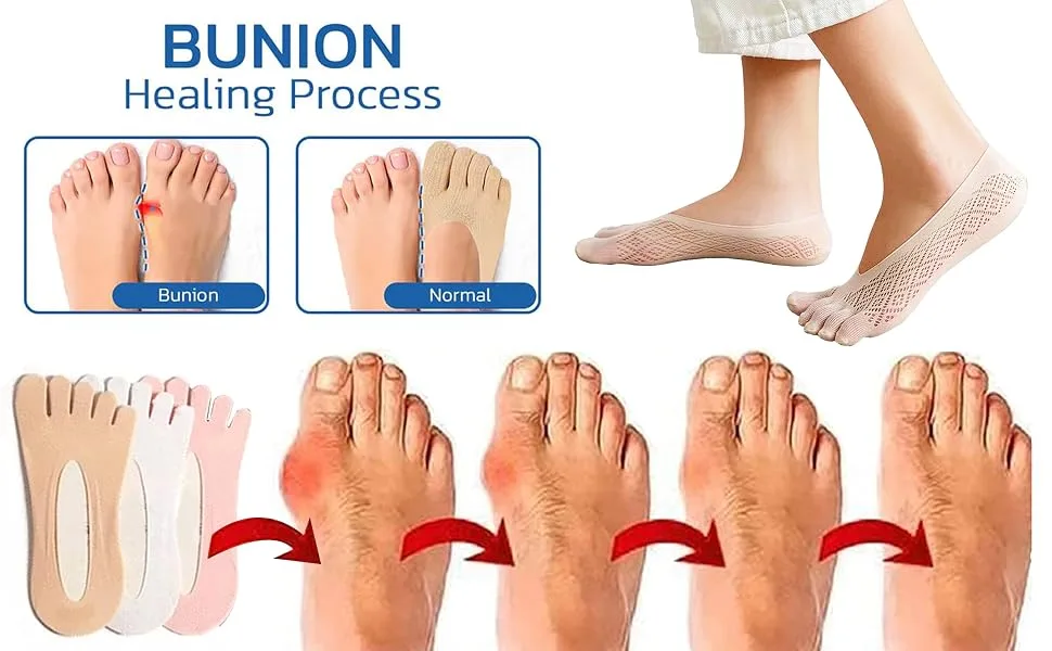 Qauxbul 5 Pairs Sock Align Toe Socks for Bunion, Orthopedic Compression Toe Sock Women, No Show Low Cut Five Finger Socks Toe Socks-B - Bunion Toe Sock