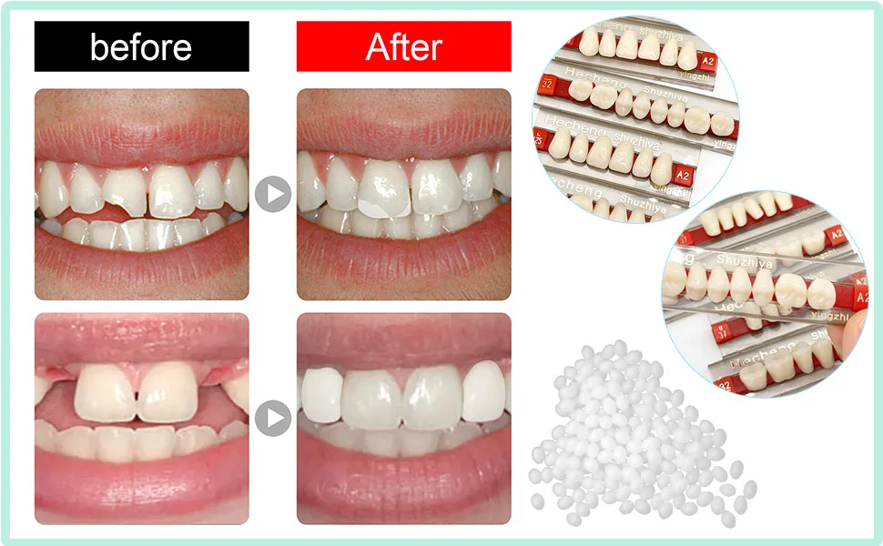 84 Pcs False Teeth Dental Complete Acrylic Resin Denture Teeth, 3 Sets Whole Teeth Synthetic Polymer Denture Tooth, 23 Shade A2 Upper + Lower Dental Materials for Replacement, DIY or Halloween - Dental false teeth