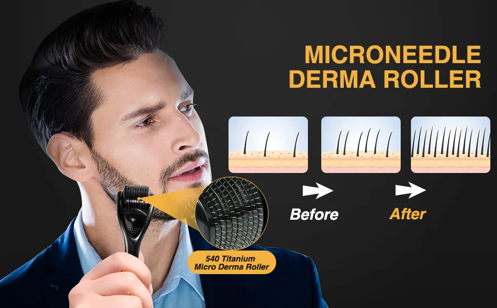 3 Packs Derma Roller for Beard Hair , Microneedle Beard Roller for Face Body,540 Titanium Microneedle Roller for Home Use with Storage Case Black 3 - Microneedle Roller for Face Body
