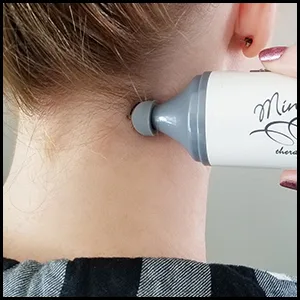 Norco NC70209 Mini Massager - Norco Mini Vibrator Massager face tmj pain jaw fascial Massage head