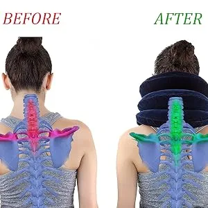 RUNZI Cervical Neck Traction Device Inflatable Neck Stretcher, Easy to Use for Chronic Neck and Shoulder Pain Relief Traction Spine Alignment, Neck Cervical Brace Grey - product information 6