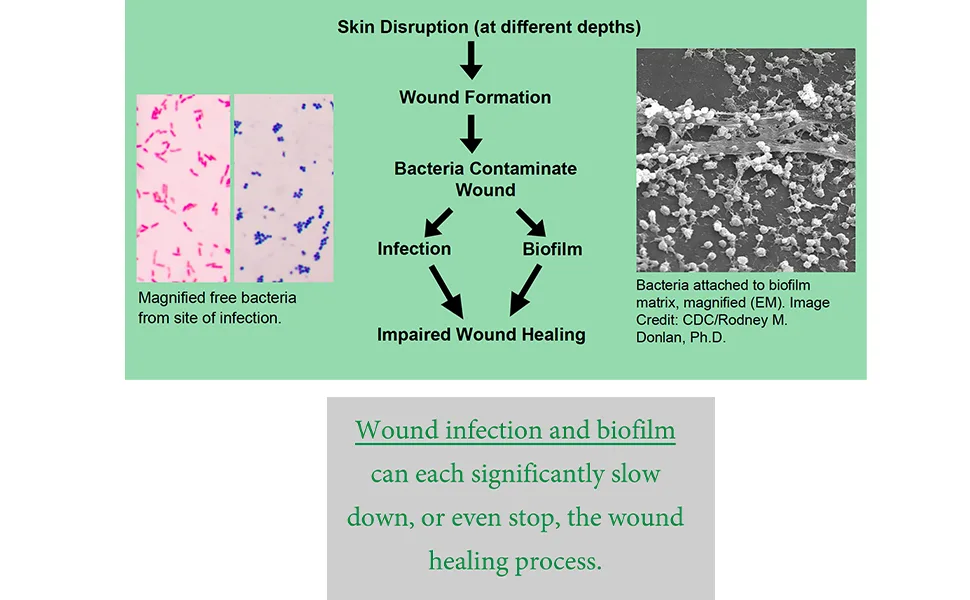 Silver Alginate (Antibacterial Alginate with Silver) 4.25"x4.25" Sterile 10 Wound Dressings Per Box (1 Box) Areza Medical - product information 7