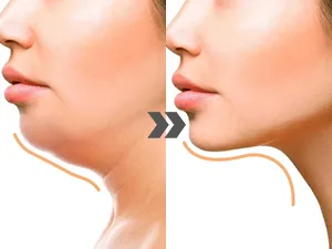 Aikertec Face Massager Electric,7 in 1 Anti-Aging High Frequency Facial Machine,Galvanic Facial Massager Machine - high frequency facial machine
