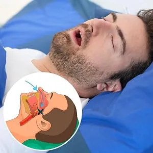 Tranquility PRO 2.0 Anti-Snoring Mouth Guard - Adjustable Mouthpiece - Night Time Teeth Mouthguard & Sleeping Bite Guard for Bruxism and Stop Snoring - Custom Molding & Adjustability - product information 2