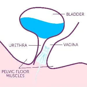 Poise Impressa Incontinence Bladder Supports for Bladder Control, Size 3, 21 Count (Packaging May Vary) - Help Stop Bladder Leaks Before They Happen