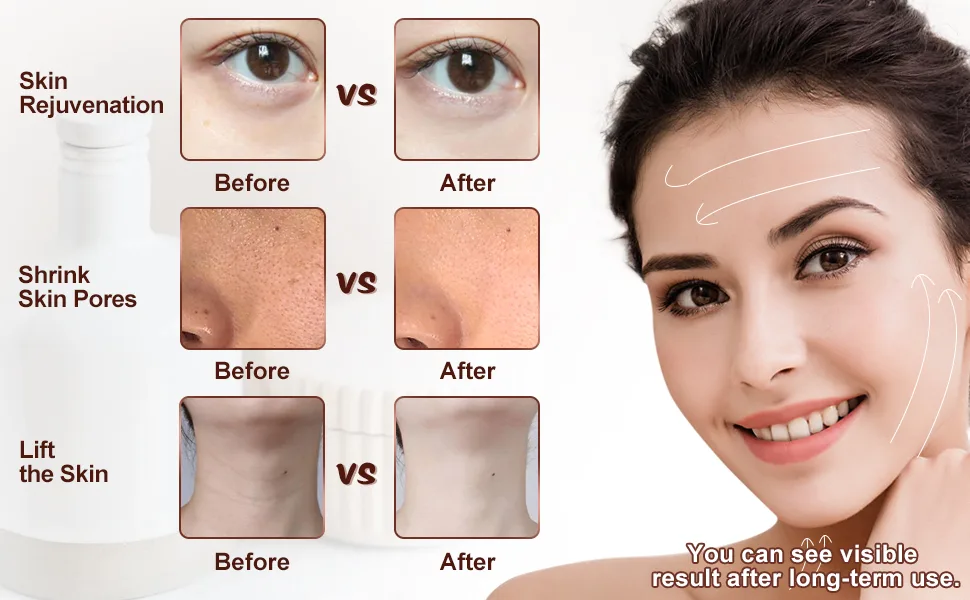 High Frequency Facial Machine, 5 in 1 Facial Massager Microcurrent Recharable Facial Frequency Wand - product information 3