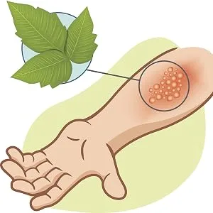 Tecnu Extreme Poison Ivy & Oak Scrub Individual Use Packets, 0.5 Ounce (Pack of 50) - tecnu technu tec nu rash poison ivy leaf oak urushiol skin leaves of three zanfel calamine spread