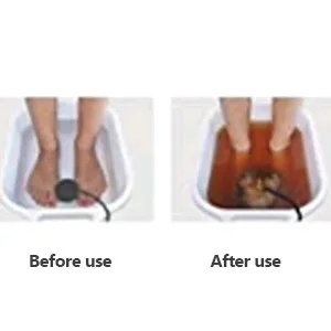 Vitaciti 12 Round Black Detox Foot Bath Arrays Stainless Steel Aqua Ionic Cleansing Accessory for Ionic Detox Foot Spa Cleanse Machines - ARRAY
