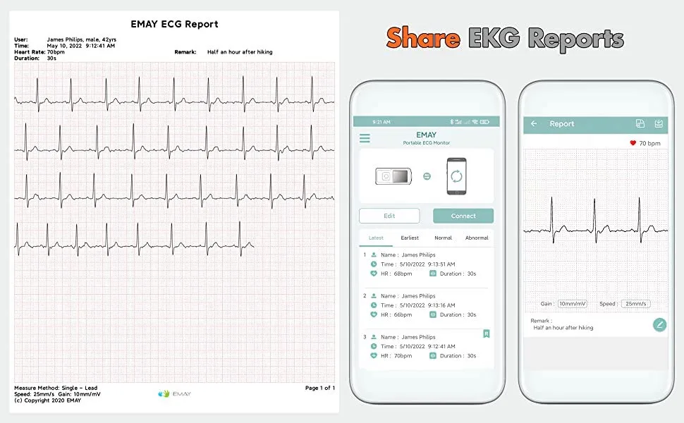 EMAY Portable ECG Monitor (for iPhone & Android, Mac & Windows) | Wireless EKG Monitoring Devices with Heart Rate & Rhythm Tracking - product information 9
